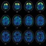 10CTE-articleLarge