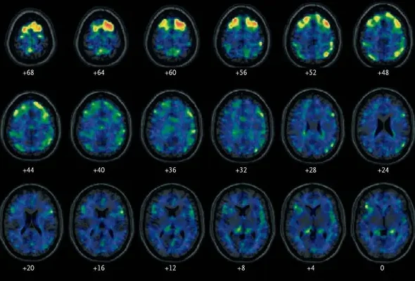 10CTE-articleLarge