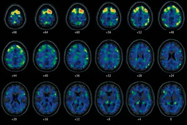 10CTE-articleLarge